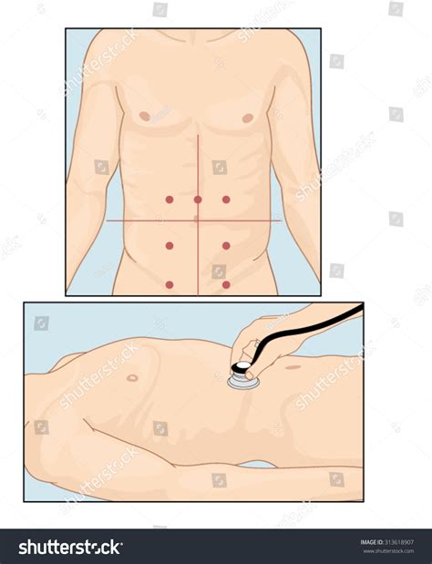 Sites Abdominal Vascular Sounds When Performing Stock Vector (Royalty Free) 313618907