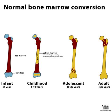 Diagram Of Yellow And Red Bone Marrow