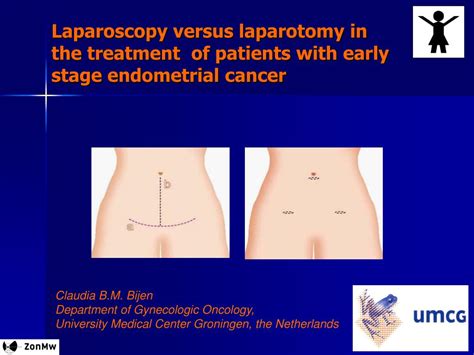 PPT - Laparoscopy versus laparotomy in the treatment of patients with ...