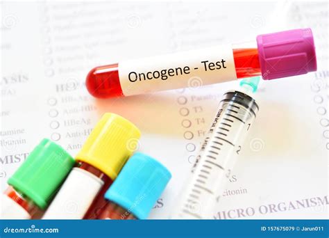 Blood Sample for Oncogene Test Stock Image - Image of laboratory, liver ...