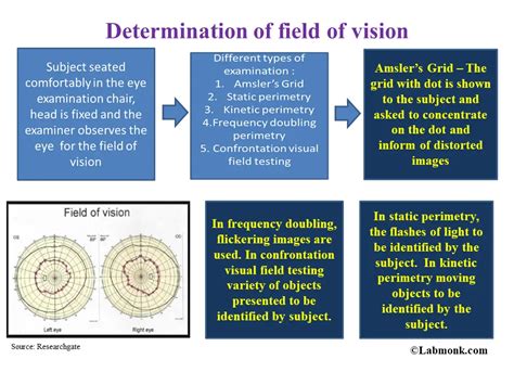 Determination of Field of Vision - Labmonk