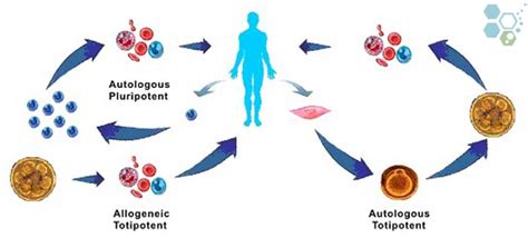 Autologous Bone Marrow Transplant