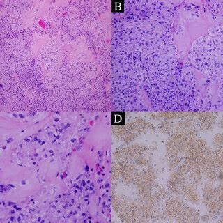 Hematoxylin and eosin (H&E) stained sections show intermixed ...