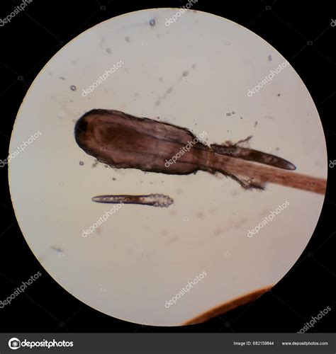 Demodex Folliculorum Parasitic Mite Eyelashes Human Eye Microscope Stock Photo by ©hydrobiolog ...