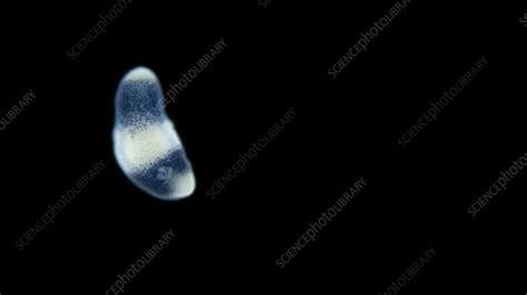 Turbellaria worm, microscopy - Stock Video Clip - K011/1568 - Science Photo Library