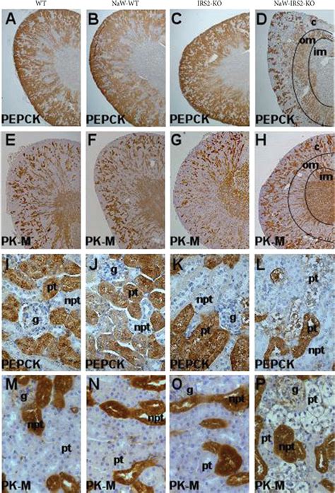 Zonation of metabolic enzymes in the kidney from NaW-IRS2-KO mice. The ...