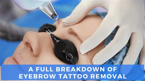 Laser Eyebrow Tattoo Removal [Our Expert Guide] | LaserAll