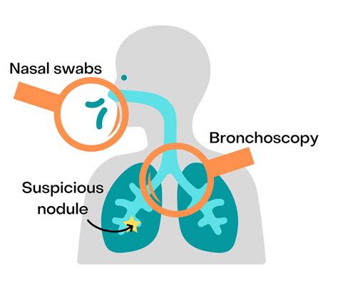 Identifying New Biomarkers to Detect Lung Cancer Earlier | Division of ...