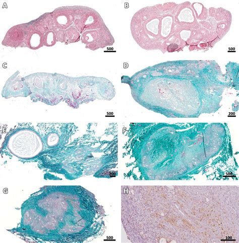 Ovarian stroma at different stages post-transplantation. Masson's... | Download Scientific Diagram