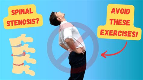 Simple Cervical Spinal Stenosis Exercises (Plus Symptoms, 45% OFF