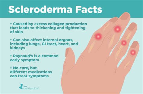 Scleroderma Face