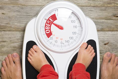 Obese children pose a major health challenge - The Statesman