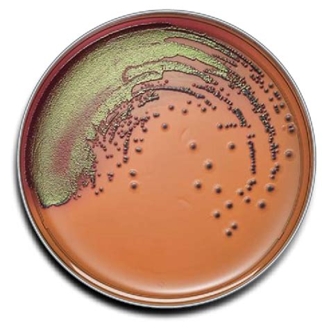 Eosin Methylene Blue Agar Plate - artfulmusing