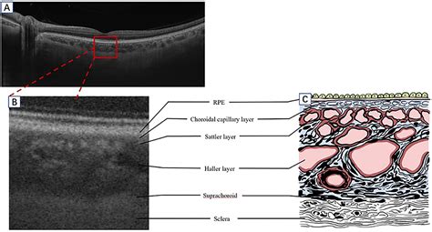 Frontiers | Evaluation of Choroidal Thickness Using Optical Coherent Tomography: A Review