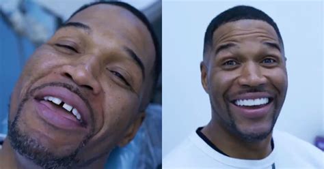 Michael Strahan Finally Gets Iconic Teeth Gap Corrected (VIDEO)