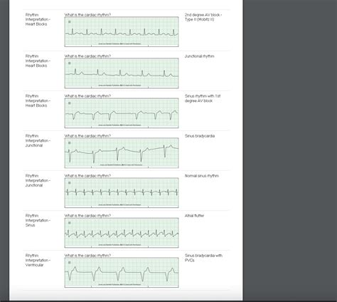 [Solved] Please help with Relias Advanced Dysrhythmia Exam A. This test ...