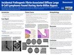 "Incidental Pathogenic Fibrin-Associated Diffuse Large B-Cell Lymphoma ...