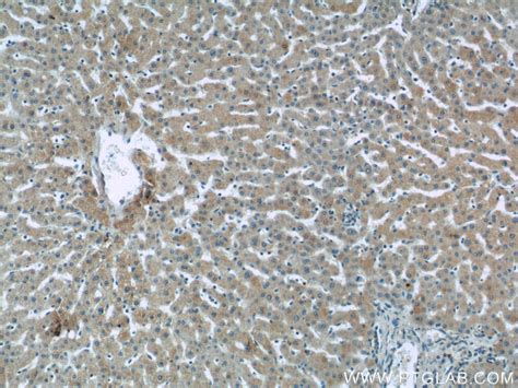 Sclerostin Antibody (21933-1-AP)