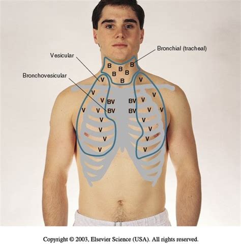 Respiratory Sounds Flashcards | Quizlet