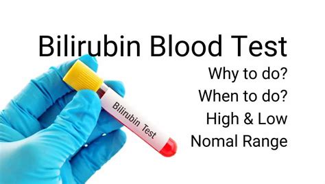 Bilirubin Test – DoctorOnHealth