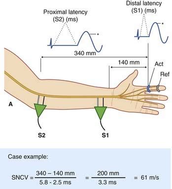 Electrodiagnostic examination | Neupsy Key