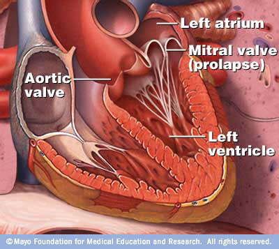 Overview of leaky heart valves - The Royal Gazette | Bermuda News, Business, Sports, Events ...