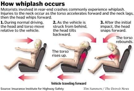 Whiplash Injury Lawyer Austin Texas | Joe Lopez Law