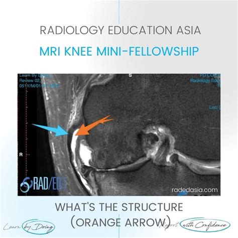 KNEE Archives - Page 3 of 8 - Radedasia