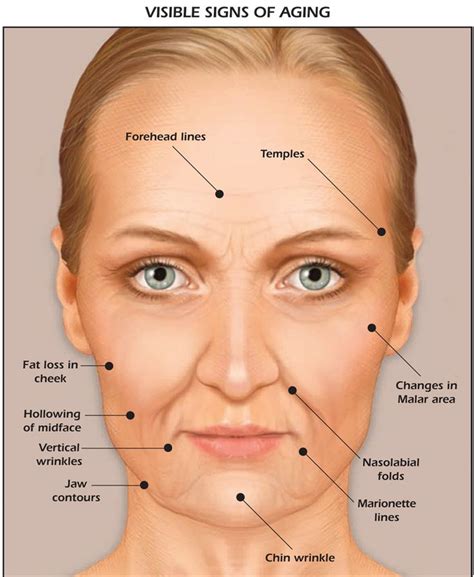 Facial Mapping Click on the image above to enlarge With aging, the ...