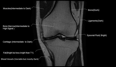 T1 vs T2 MRI | T1and T2 MRI image comparison