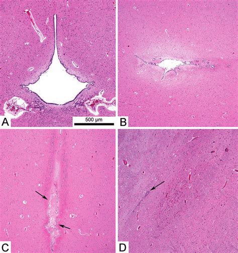 Photomicrographs showing cerebral aqueducts in a range of obstructed... | Download Scientific ...