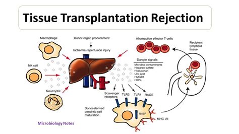 Mechanism of cellular rejection in transplantation - Microbiology Notes