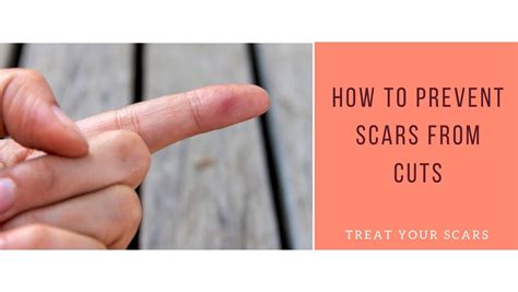 How To Prevent Scars From Cuts - Treat Your Scars