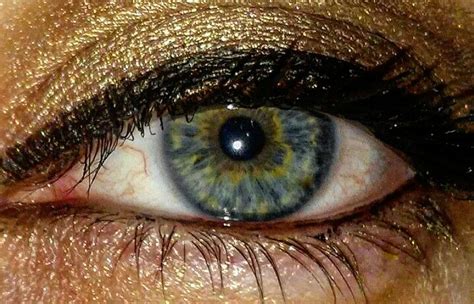 I have central heterochromia.. Blue grey eyes with yellow starburst and ...