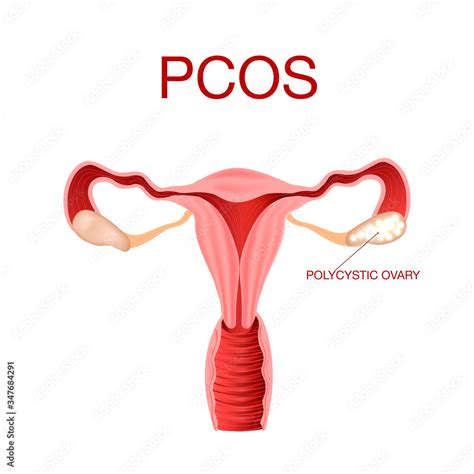 Vector realistic medical illustration of healthy female reproductive ...