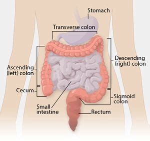 Colorectal Cancer - Physiopedia