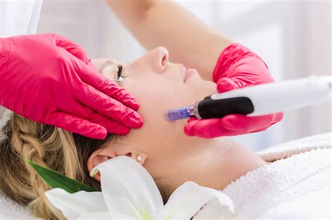 Micro Needling Skin Improvement Therapy in Orlando, Fl | Sanctuary