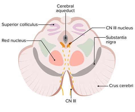 Anatomical models of the brain pontine medulla oblongata and the ...