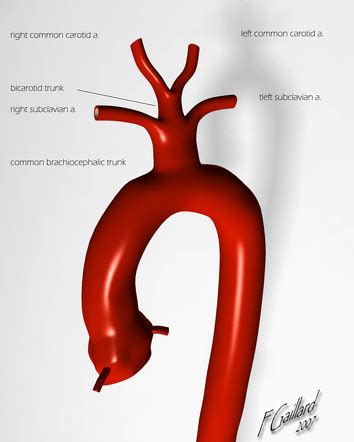 Image | Radiopaedia.org