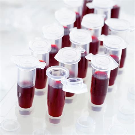 Blood Samples In Centrifuge Tubes Photograph by Science Photo Library - Fine Art America