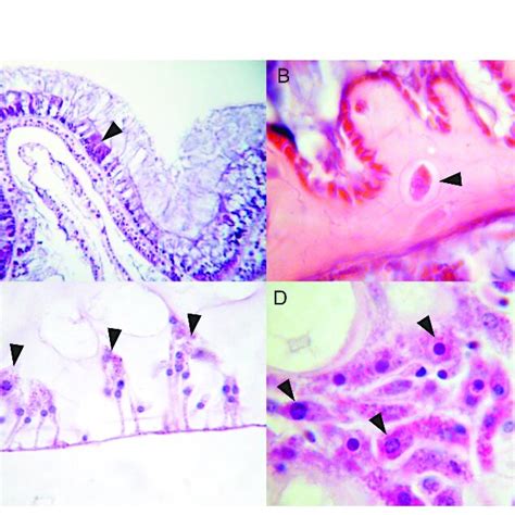 Amoebocytes in Hexacorals and Octocorals (A) Scleractinian hexacoral... | Download Scientific ...