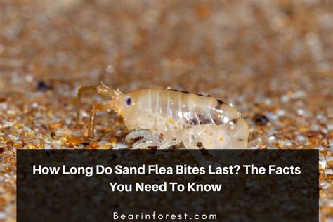 How Long Do Sand Flea Bites Last? The Facts You Need To Know