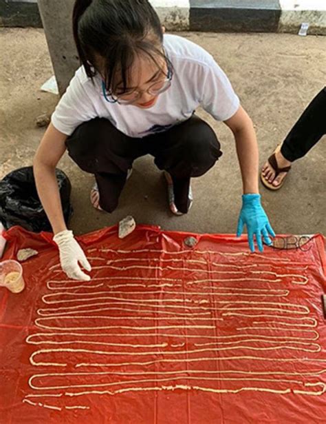 Gigantic 59ft tapeworm emerges from man’s bum after he complained of stomach pain