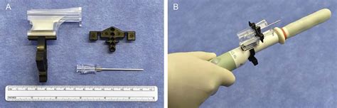 Initial Experience Performing In-office Ultrasound-guided Transperineal ...