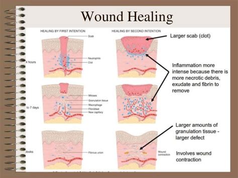 Wound management by saumya agarwal