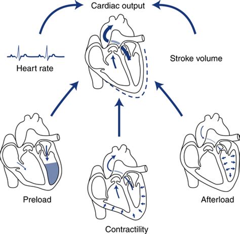 Cardiac Output Measurement | Thoracic Key