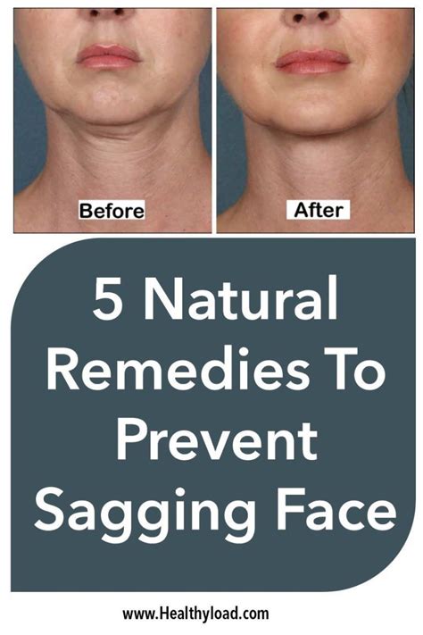 5 natural remedies to prevent sagging face - Beauty Webmd | Sagging face, Skin care remedies ...