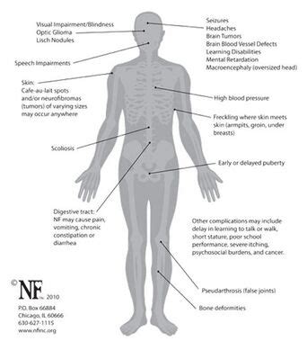 Neurocutaneous Syndromes - Physiopedia