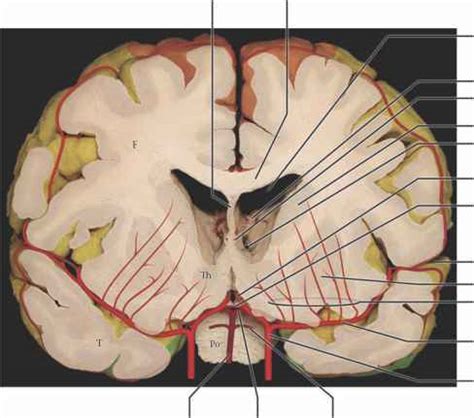 Internal capsule photographic view with overlay - Spinal Cord