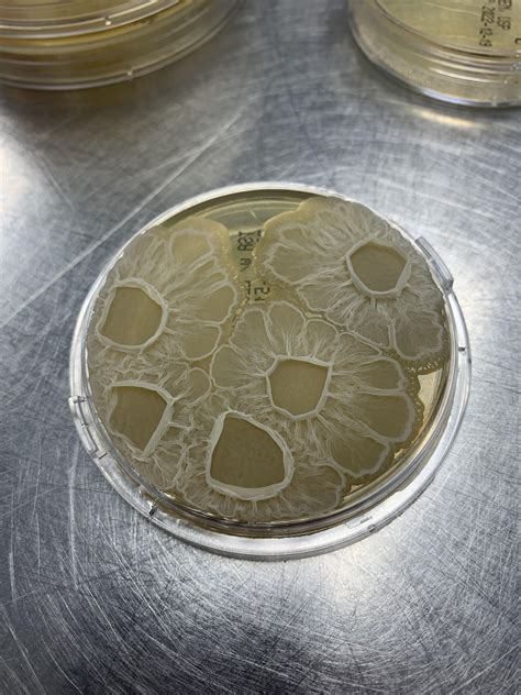 Pretty flowers on these TSA rodac plates : r/microbiology